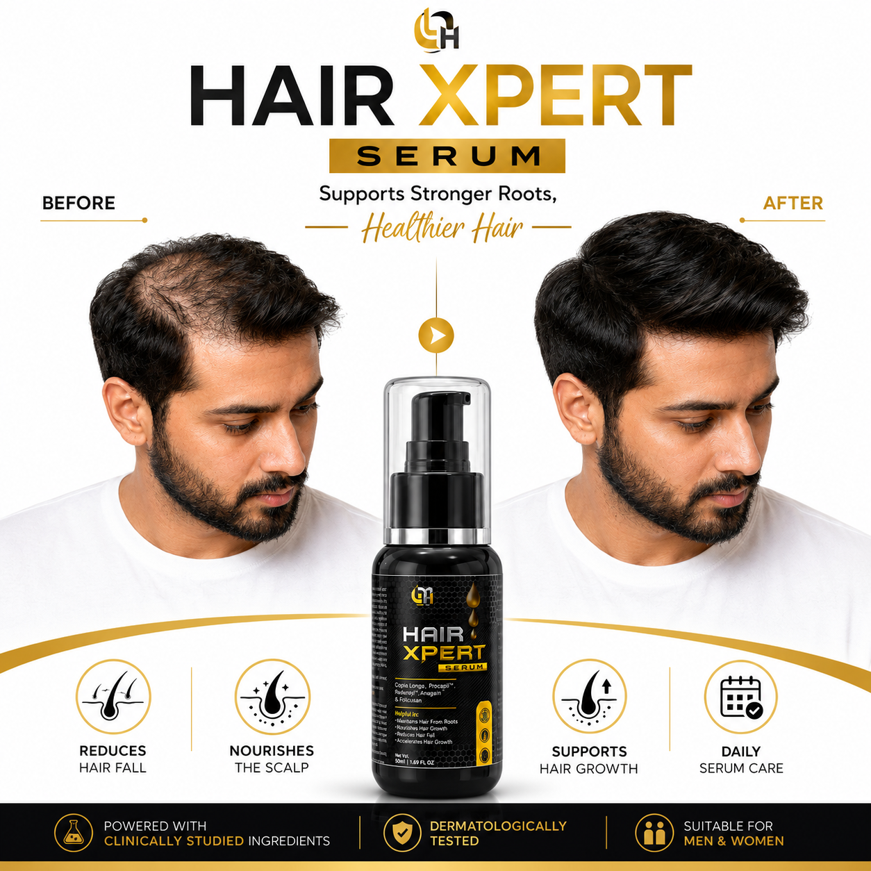 GM Hair Xpert Serum – 30ml | Hair & Scalp Care Serum poster 1